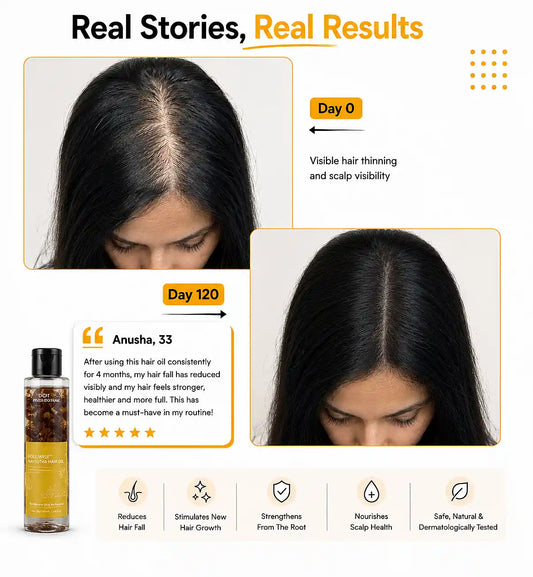 Before and after hair growth results using Root Botanie Folliwise Navsutra Hair Oil, visible scalp coverage improvement, Ayurvedic hair oil for thinning hair and regrowth.