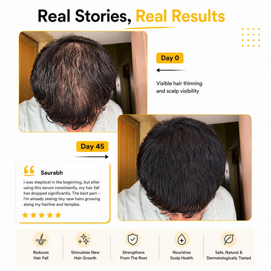 Real results customer with Root Botanie Folliwise Men Scalp Microbiome Balance Capsule Best Hair Growth supplement in India for Men