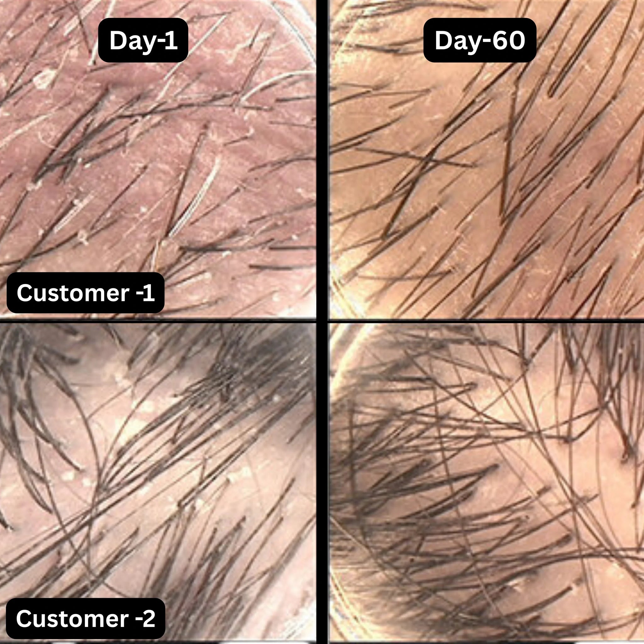 Proven Tips to Reduce Hair Fall and Thinning: Dermatologist-Recommended Routines for Urban Indians
