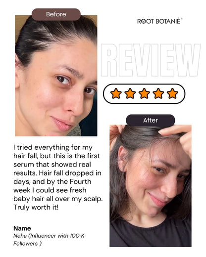 Before and after review of a hair serum with a woman's face and hair shown, featuring five-star rating and text about results. for Root Botanie folliwise Hair Vital Serum . 