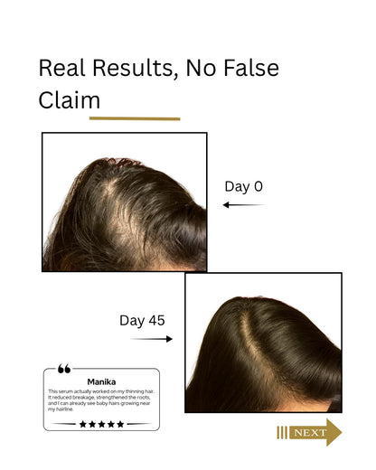 Real hair regrowth with Root Botanie Folliwise Women advance hair Vital Serum.
