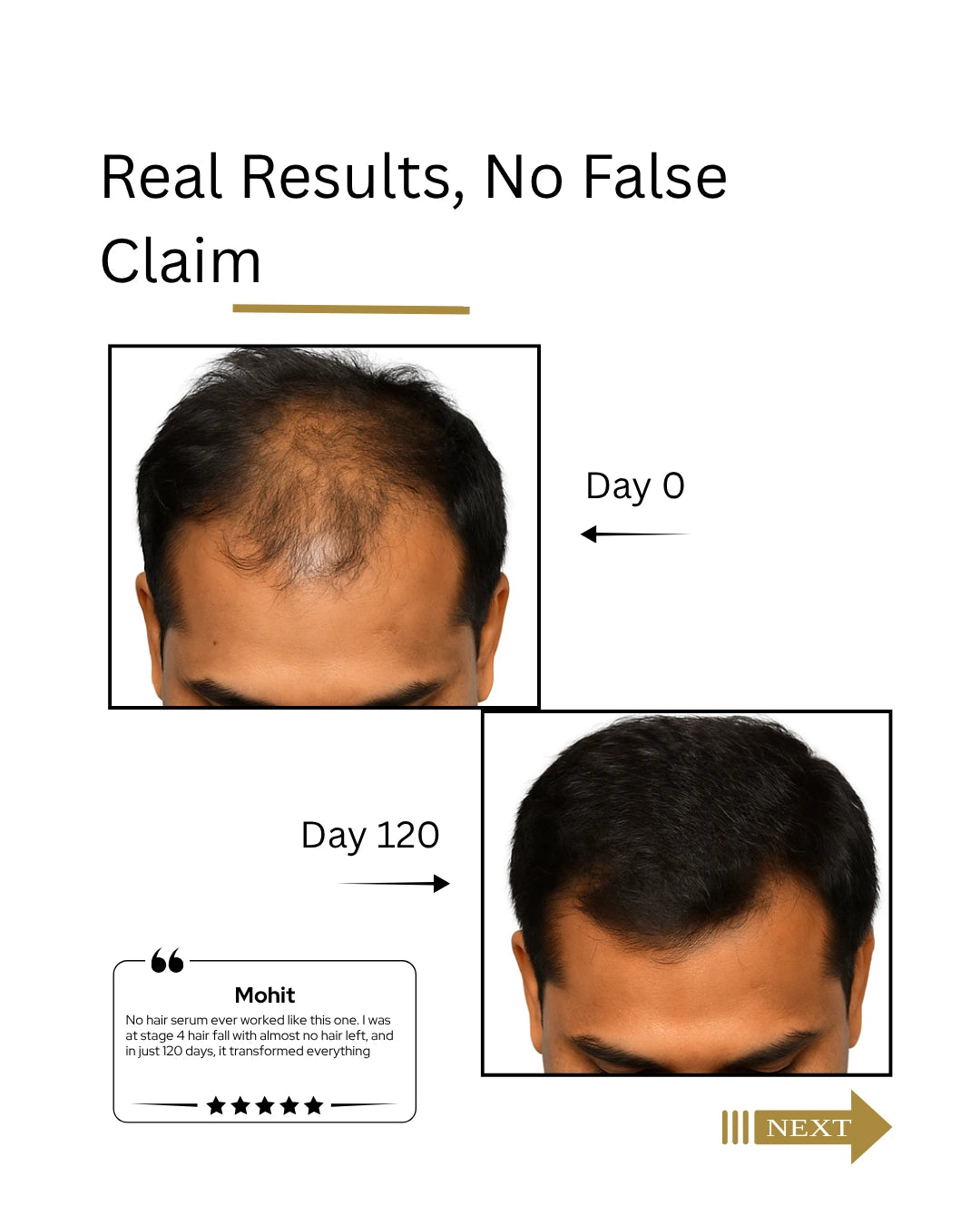 Complete Inside-Out Hair Growth System for Men