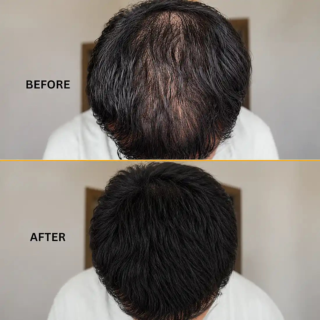 Support Hair Regrowth 