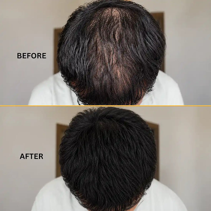 Support Hair Regrowth 