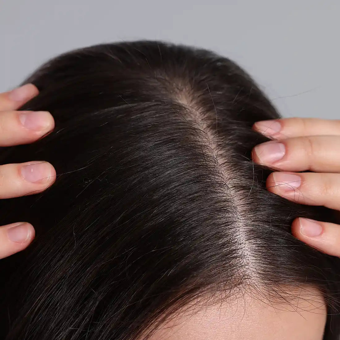 Improves Scalp Health