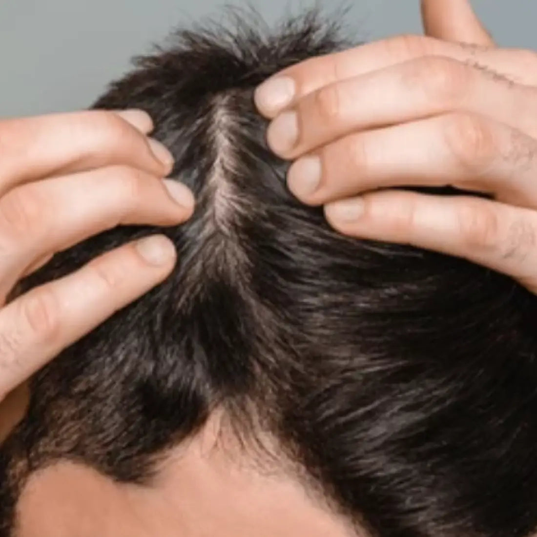 Reduce Thinning
