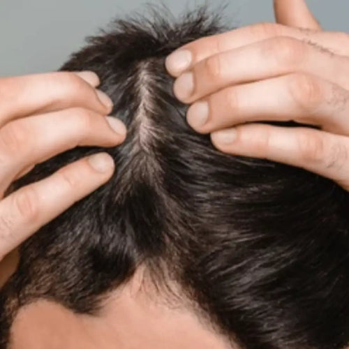 Reduce Thinning