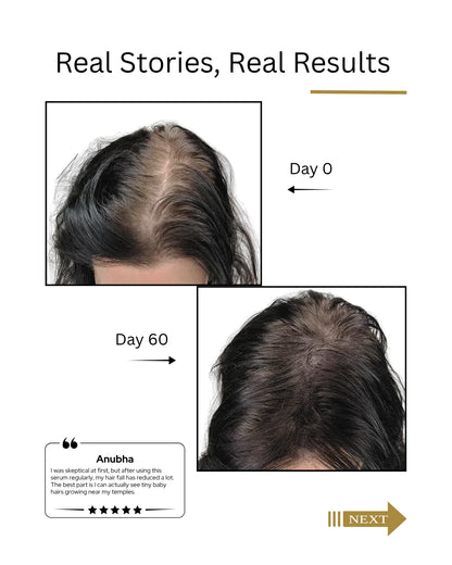 Before and after hair transformation showing hair growth over 60 days. by   Root Botanie Folliwise Women Scalp Microbiome Balance Capsules for hair fall and hair regrowth