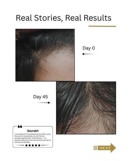 Before and after hair growth comparison for Men Root Botanie Folliwise Men Advanced Hair Vital Serum Dermatologist recommended best hair growth serum for Men 