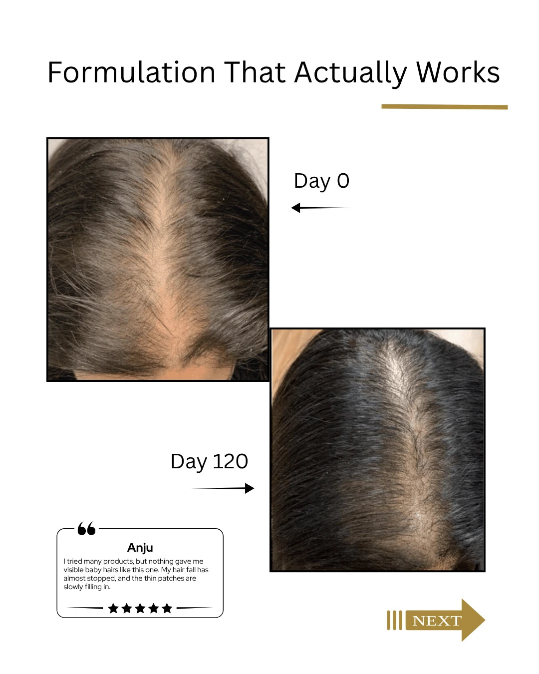 Real hair regrowth with Root Botanie Folliwise Women advance hair Vital Serum.