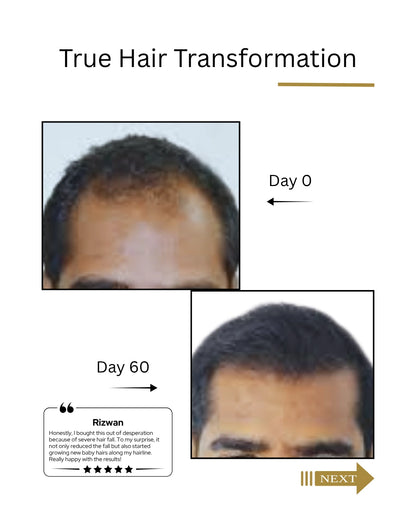 True Hair Transformation before and after images with text labels on a white background dermatologist recommended India's  best hair regrowth serum for Men , Root Botanie FOLLIWISE men Scalp Microbiome Balance Capsules | Doctor-Recommended Hair Regrowth & Hairfall Control Supplement