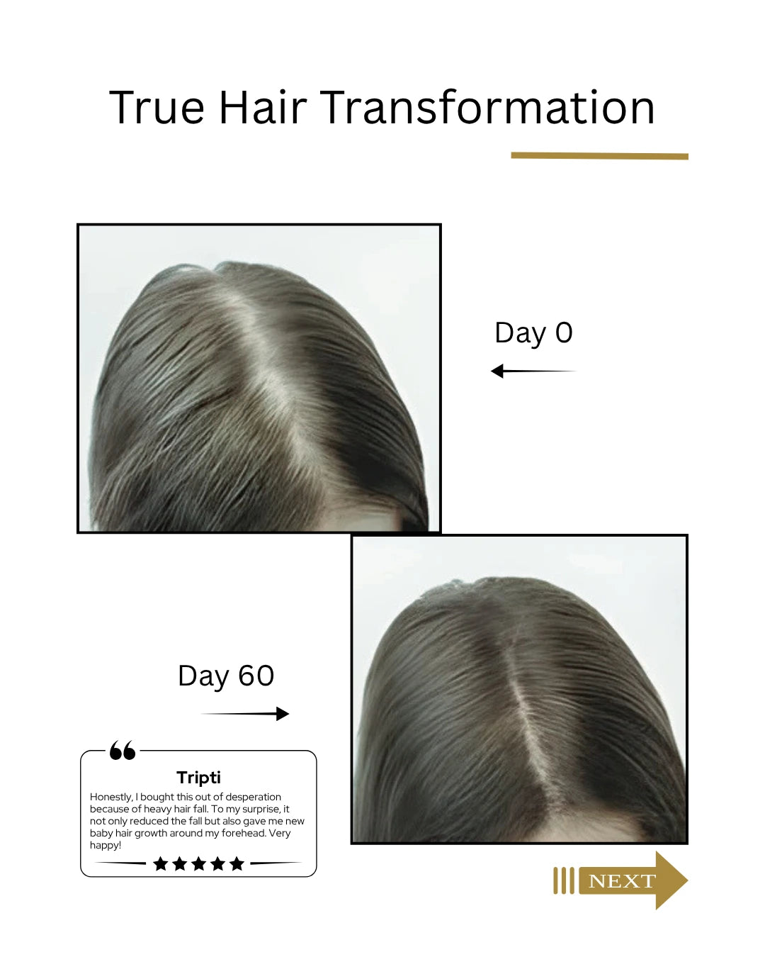 Before and after hair transformation showing hair growth over 60 days. by   Root Botanie Folliwise Women Scalp Microbiome Balance Capsules for hair fall and hair regrowth