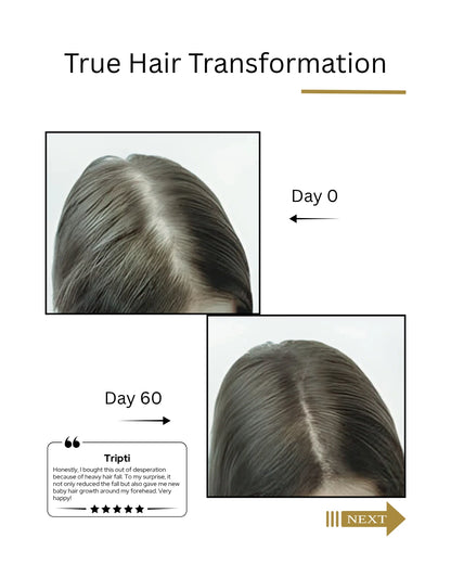 Before and after hair transformation showing hair growth over 60 days. by   Root Botanie Folliwise Women Scalp Microbiome Balance Capsules for hair fall and hair regrowth