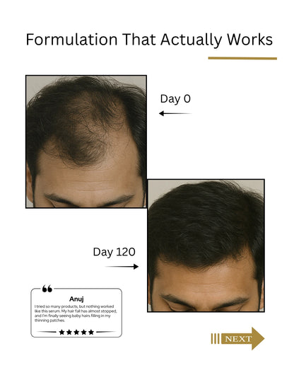 Before and after comparison of hair growth treatment on a person's head, showing results over 120 days.