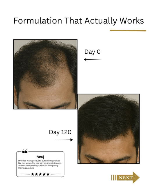 Before and after comparison of hair growth treatment on a person's head, showing results over 120 days.