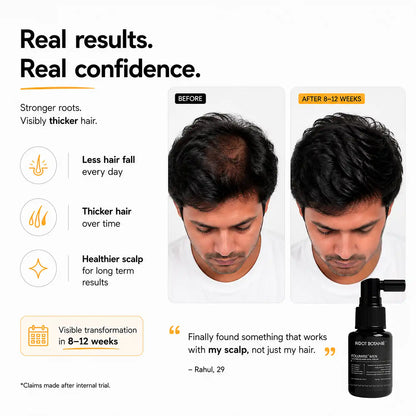 DHT Defense & Scalp Detox Combo for Men