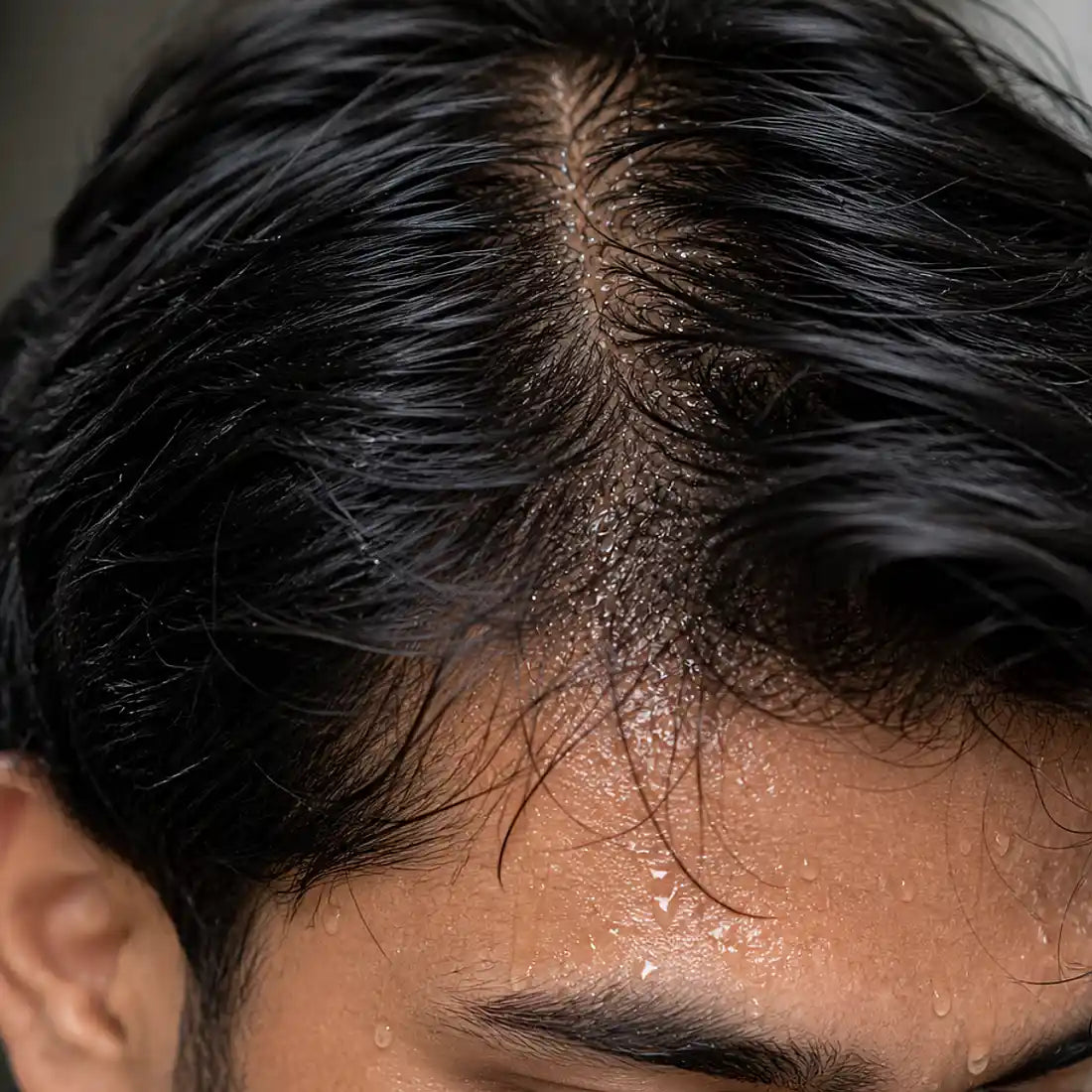Scalp detox