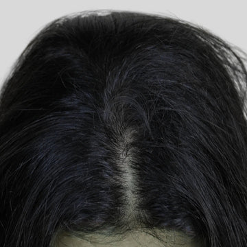 Damaged Hair & Scalp