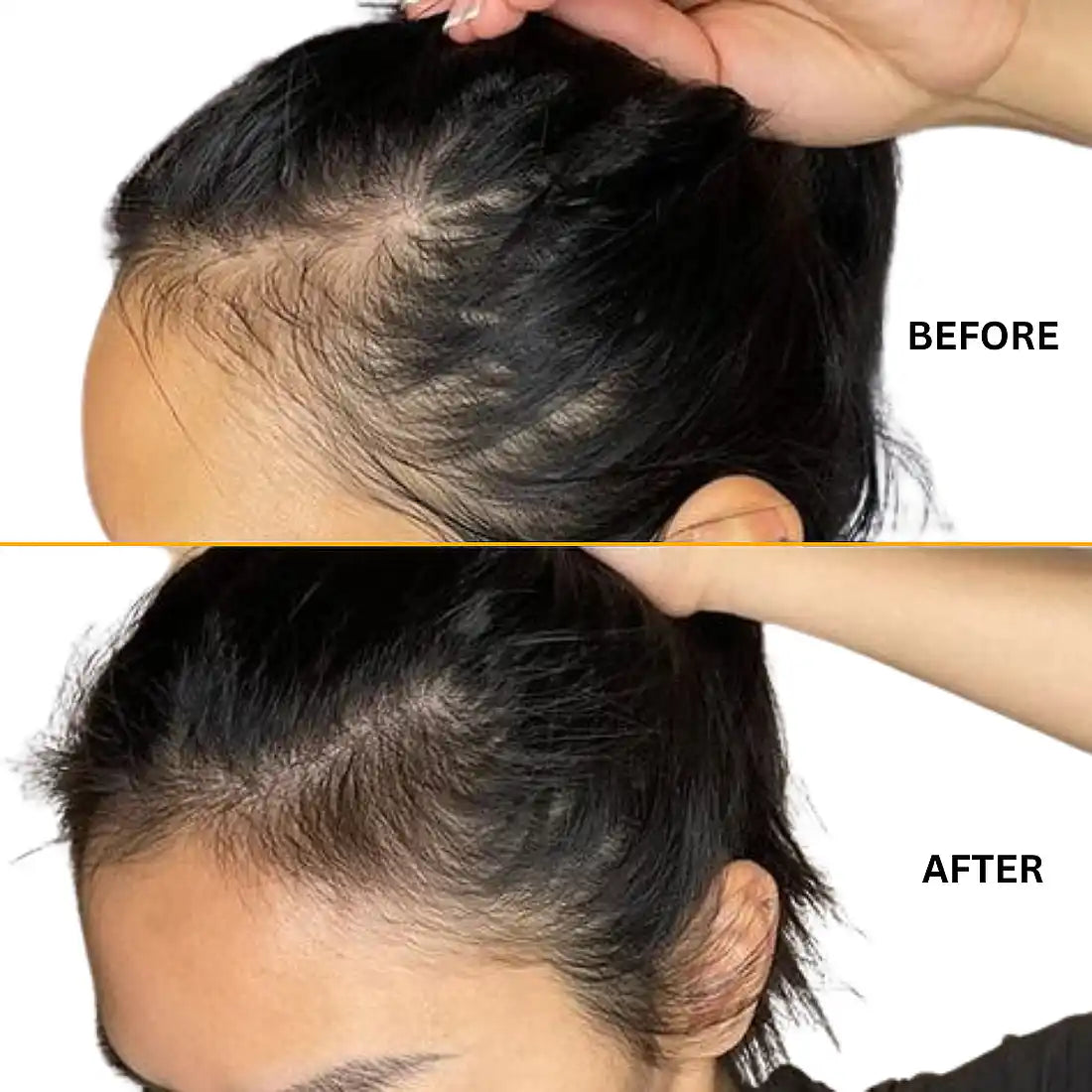 Supports Hair Regrowth 