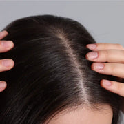 Free AI Scalp Analysis by Hair Expert