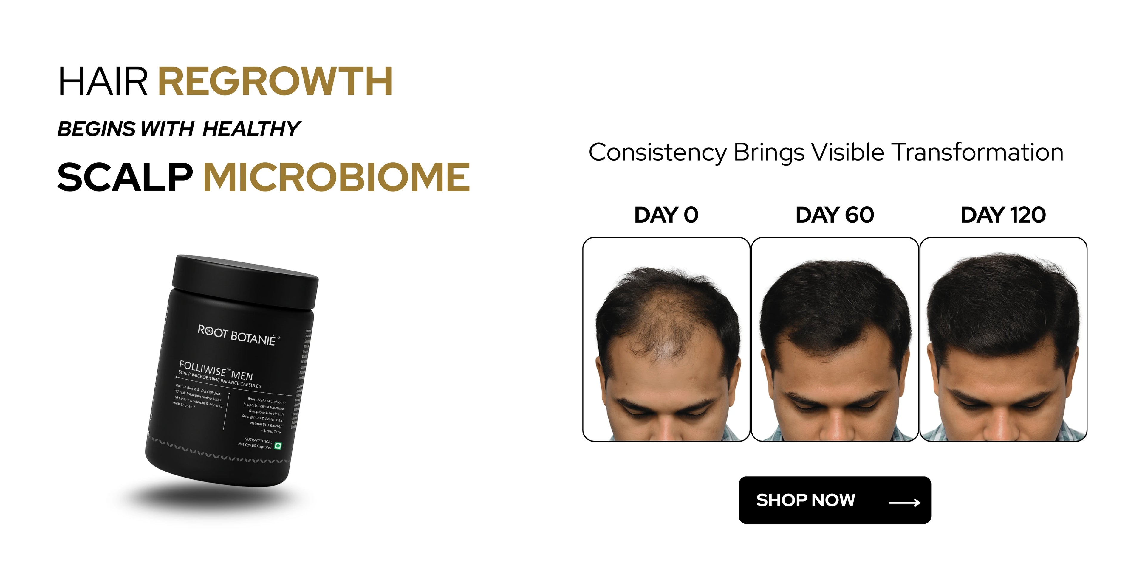 ROOT BOTANIE HAIR REGROWTH SOLUTION FOR MENslider_item_7ANwJU