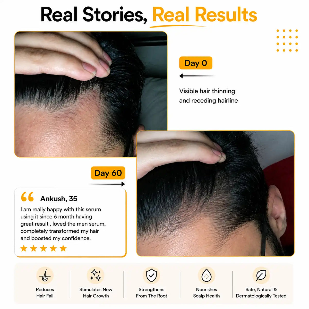 Real customer results Root Botanie Folliwise Men Hair Growth Serum faster hair growth designed for men only , best hair regrowth serum No Minoxidil. 