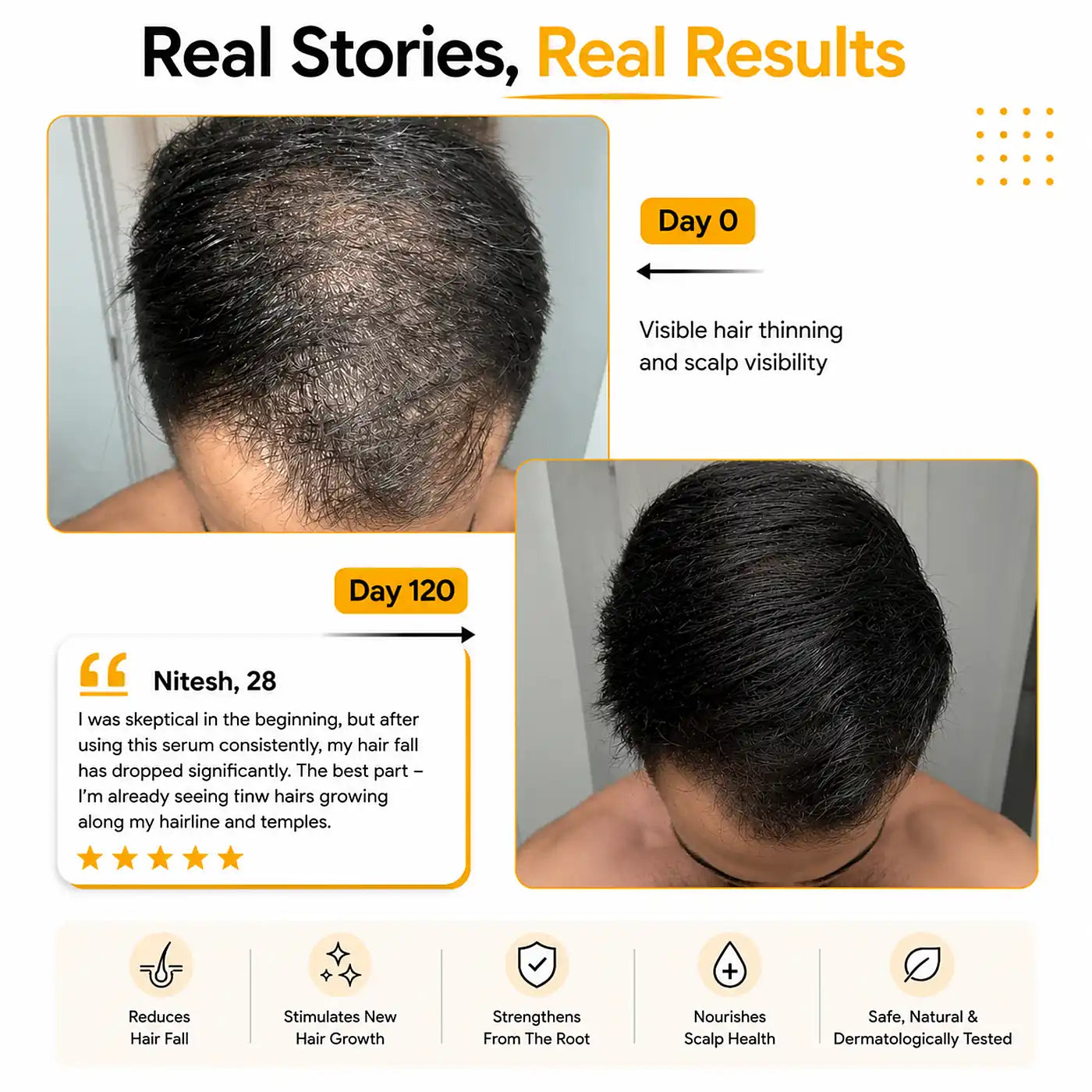 Real customers results Root Botanie Folliwise Men Hair Growth Serum faster hair growth designed for men only , best hair regrowth serum No Minoxidil. 