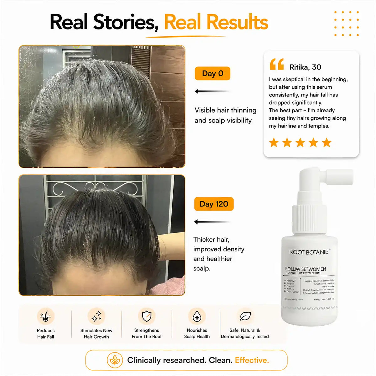 Real results Root Botanie folliwise women advance hair vital serum for men dermatologist t recommended for Women for hair growth 