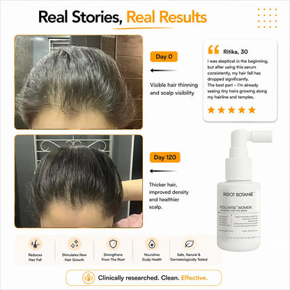 Real results Root Botanie folliwise women advance hair vital serum for men dermatologist t recommended for Women for hair growth 