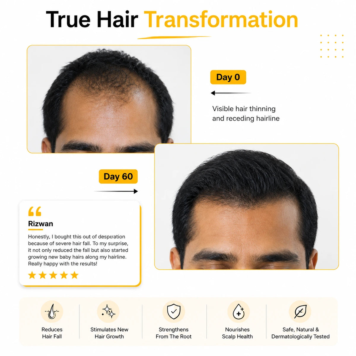 Real results customer with  Root Botanie Folliwise Men Scalp Microbiome Balance Capsule Best Hair Growth supplement in India for Men