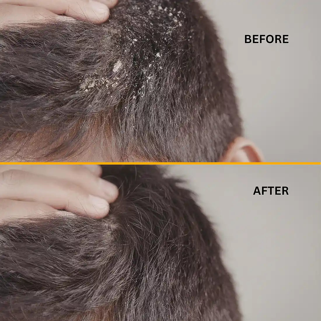 Reduces dandruff 