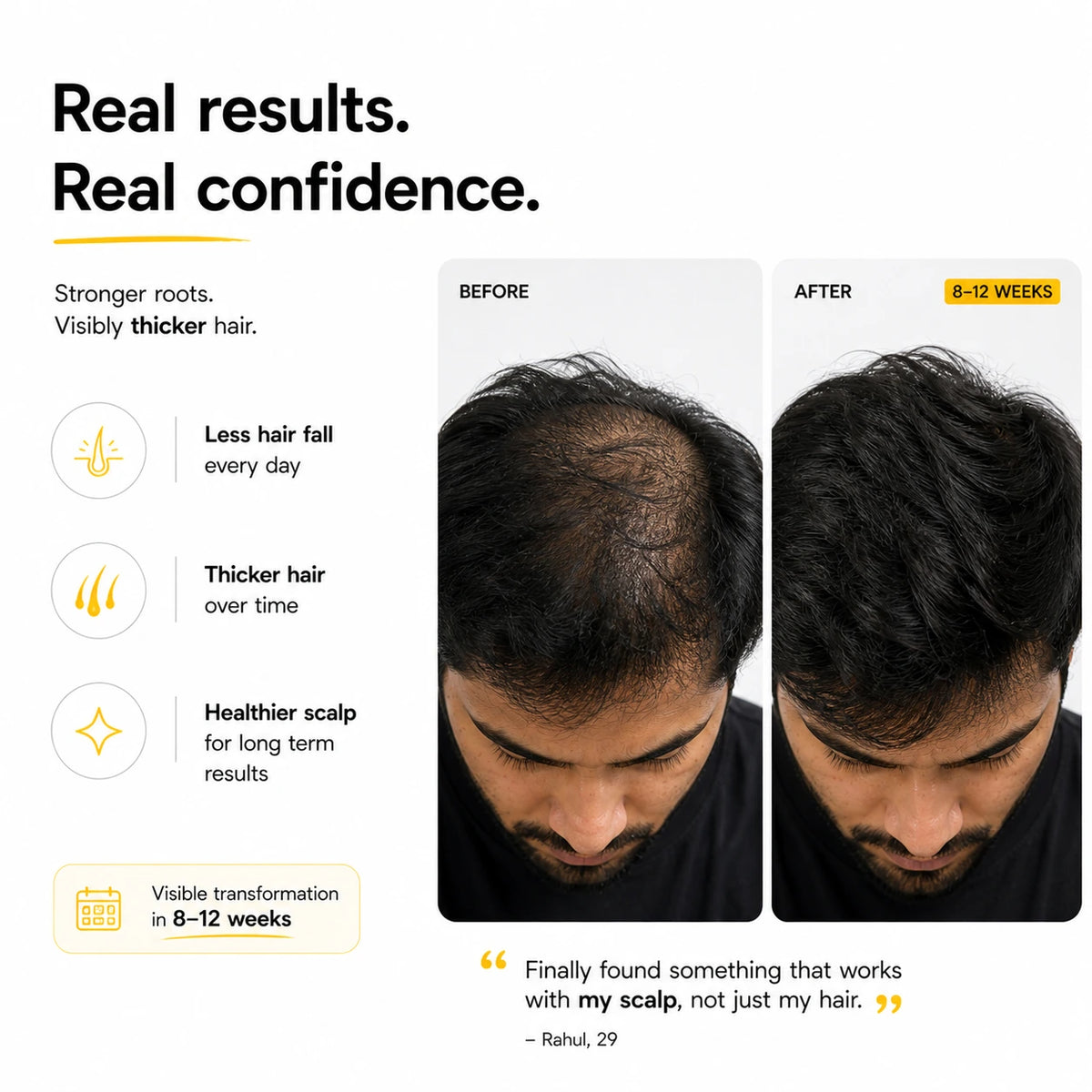 Real results customer with  Root Botanie Folliwise Men Scalp Microbiome Balance Capsule Best Hair Growth supplement in India for Men