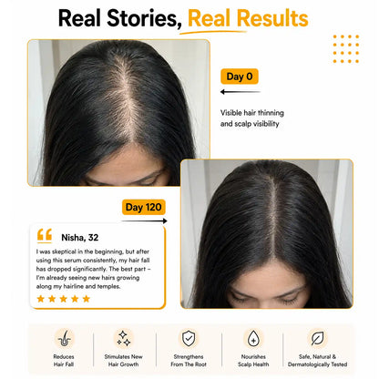 Results Root Botanie folliwise women advance hair vital serum for men dermatologist t recommended for Women for hair growth  work