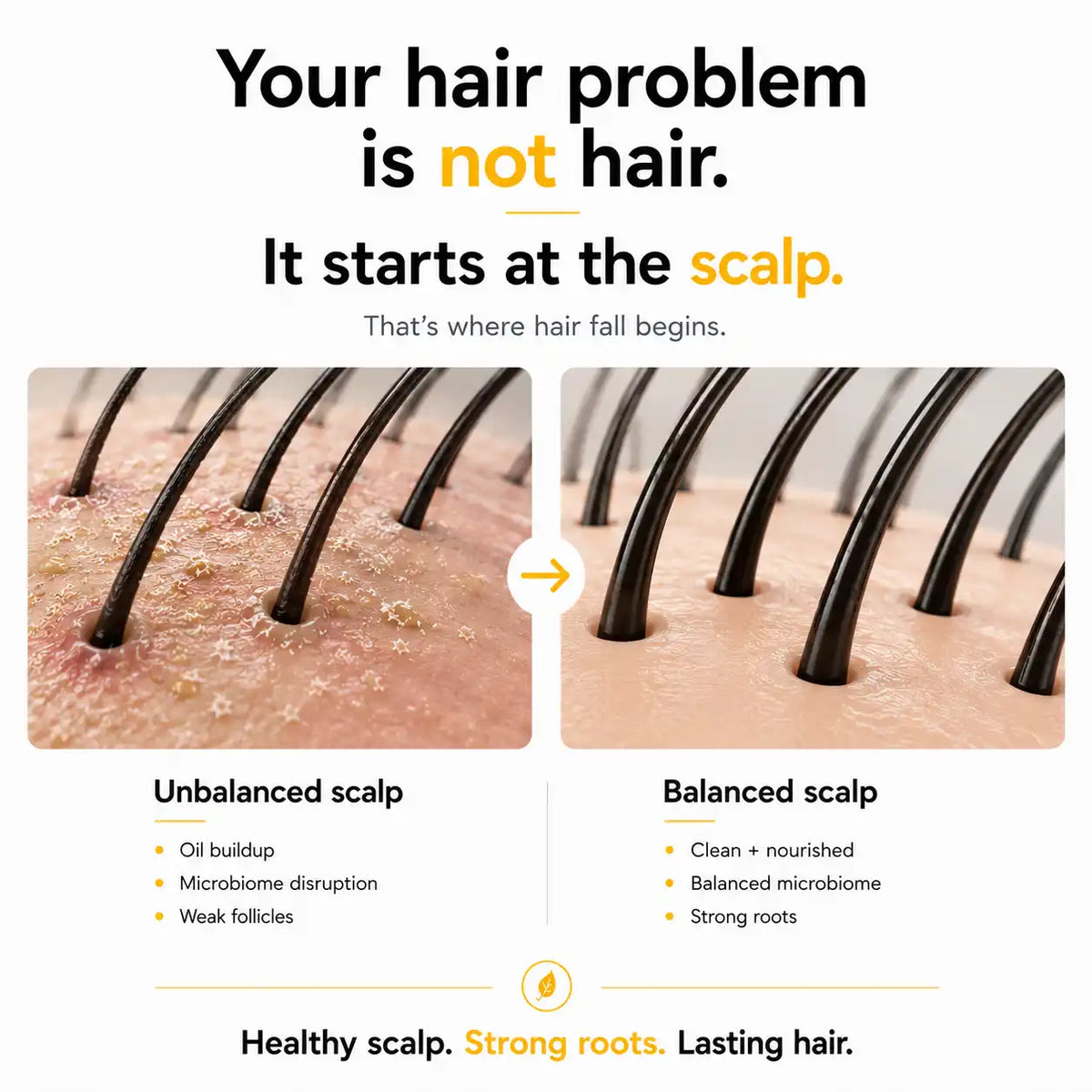 Ingredient Root Botanie Women Scalp Microbiome Balance capsule, best hair growth supplement for Women. 