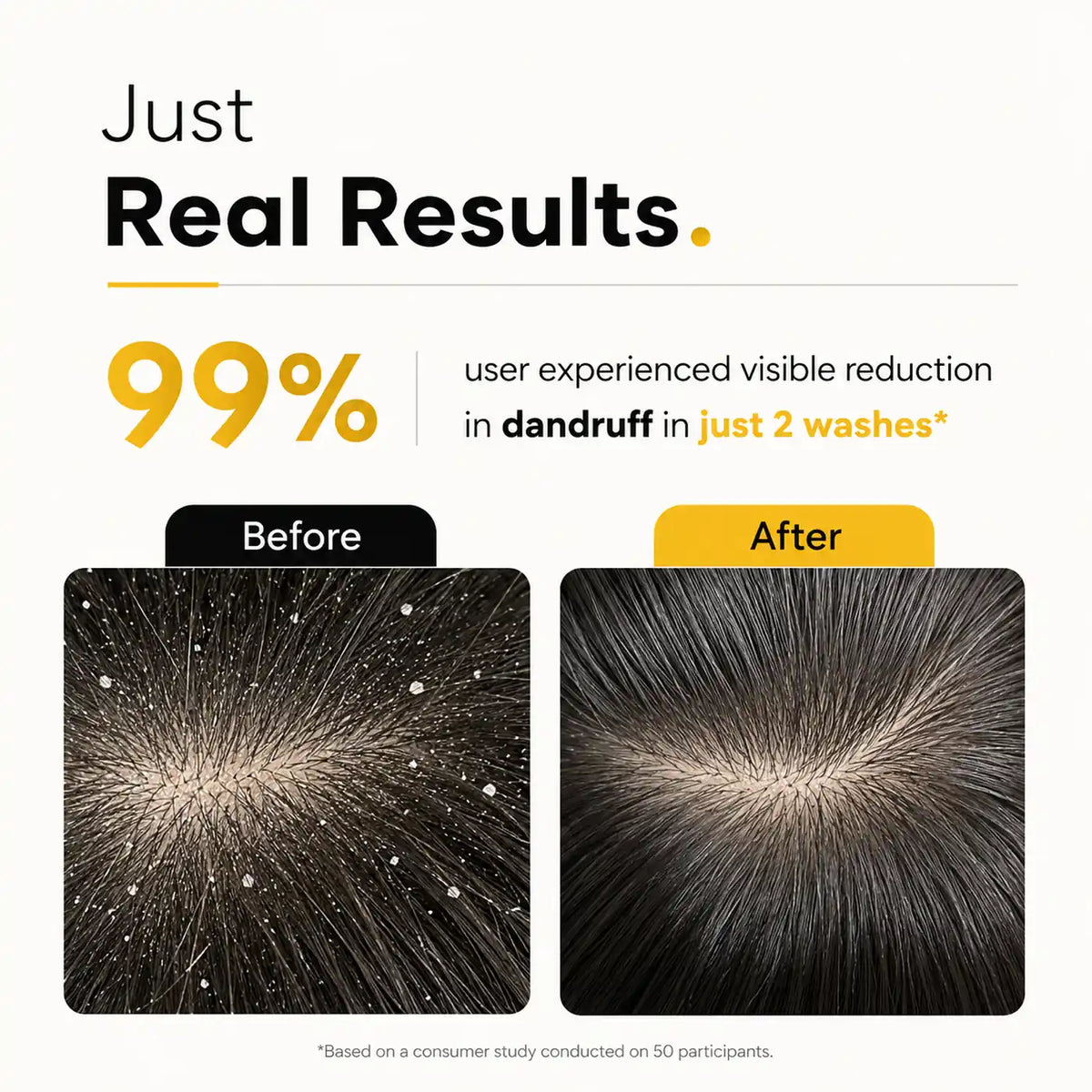 Root Botanie Anti Dandruff anti pollution shampoo 100% dandruff clean best for Scalp Microbiome balance, DHT blocker , hard water shampoo, dermatologist recommended medicated shampoo for Oily Hair and Scalp 